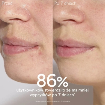Serum do twarzy Vinopure Blemish Control Salicylic Serum 30 ml