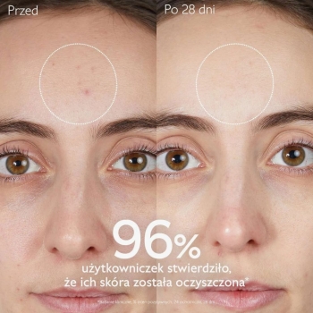 Żele do mycia twarzy Vinopure Purifying Gel Cleanser 150 ml