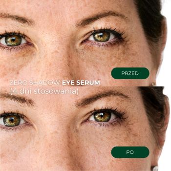 Zestaw do pielęgnacji twarzy dla niej Zero Shadow Eye Complex 