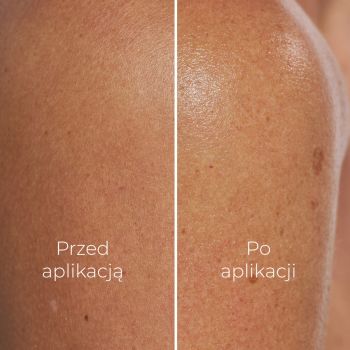 Balsamy do ciała Gel Trap 250 ml