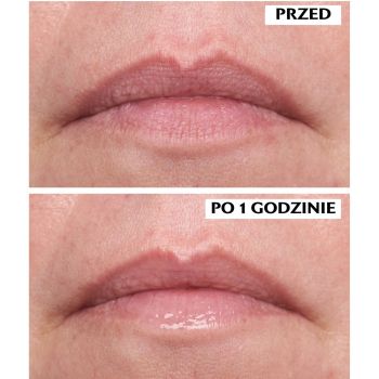 Balsamy do ust Hyaluronic Omega Moisture Lip Mask 10 ml