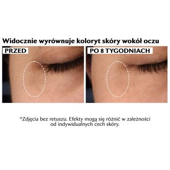 Serum pod oczy Multi-action Super-C Dark Circle Brightening Eye Serum 15 ml