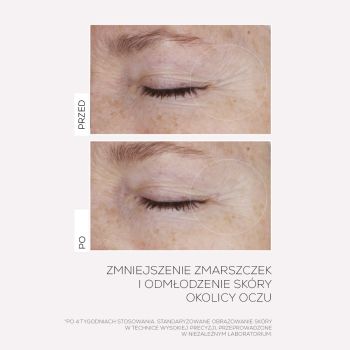 Kremy pod oczy Infusion Lift Pro-lift Ultimate Eye Cream 15 ml