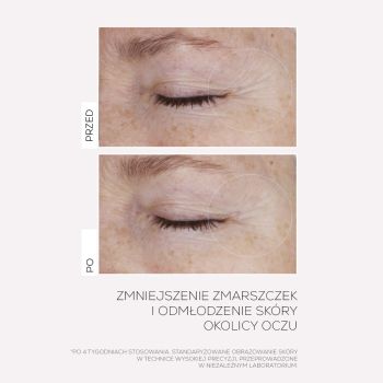 Kremy pod oczy Infusion Lift Pro-lift Ultimate Eye Cream 15 ml