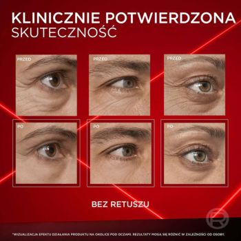 Kremy pod oczy Revitalift Laser Eye Bag Instant Erase 15 ml