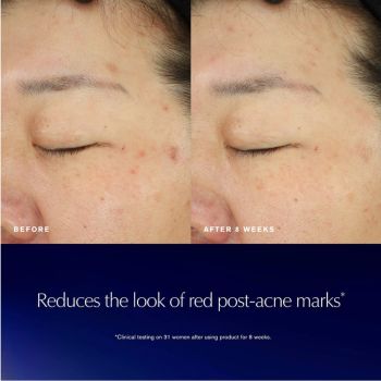 Serum do twarzy Advanced Night Repair Recovery Treatment Essence 200 ml