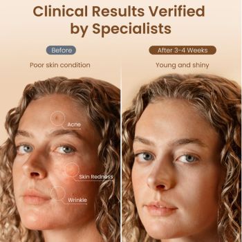 Maski LED Rejuven Artemis Blush LED Light Therapy Mask 