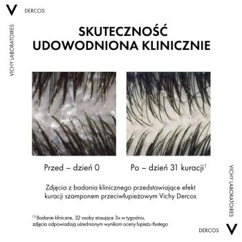 Szampony do włosów Dercos Anti-Dandruff Shampoo Normal to Oily Hair 200 ml