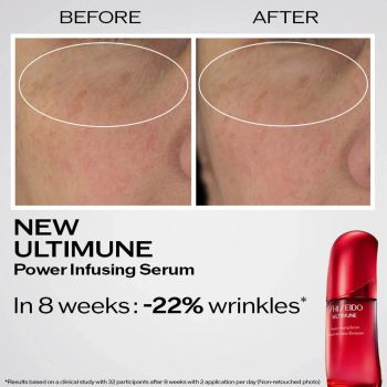 Serum do twarzy Ultimune Power Infusing Serum 4.0 100 ml