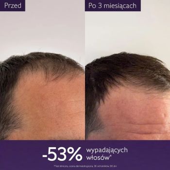 Pielęgnacja włosów i skóry głowy Anti-Hair Loss Hair Serum 50 ml