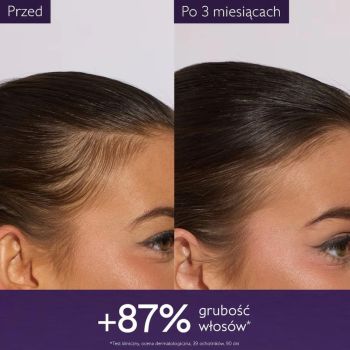 Pielęgnacja włosów i skóry głowy Anti-Hair Loss Hair Serum 50 ml
